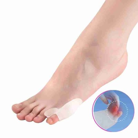 Hallux Valgus - kiero pikkuvarvas 2-pack