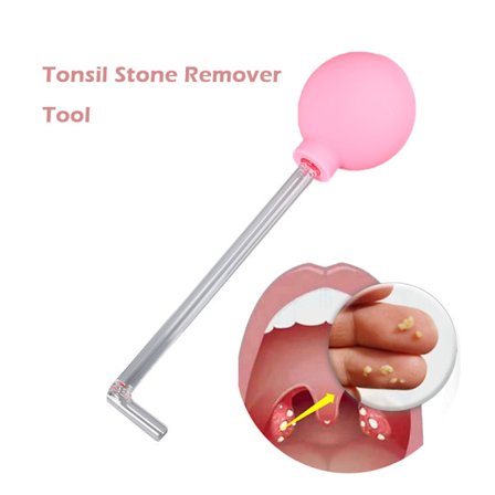 Tonsil Stone Remove Tool Manual Style Cleaner Munvård
