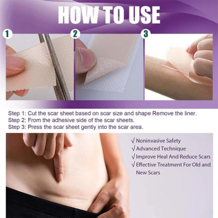 Silikonärrborttagningsark mjukar upp C-sektionen hypertrofiska kirurgiska ärr 4x15cm