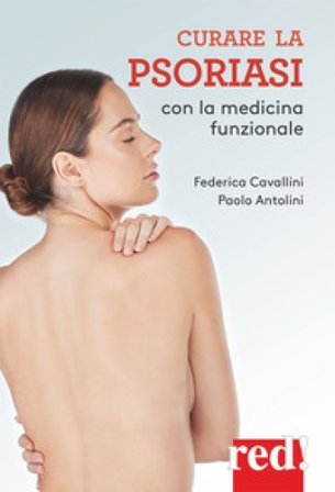 Curare la psoriasi con la medicina funzionale Federica Cavallini