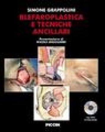Blefaroplastica e tecniche ancillari. Con DVD Simone Grappolini