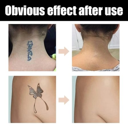 2 Farver Tattoo Concealer Sæt Fuld Dækning Makeup Dækker Vandtæt Svedtæt Hud Concealer til Fødselsmærker Mørke Pletter Ar