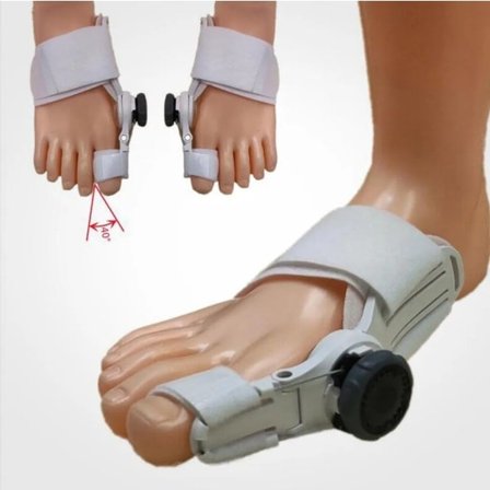 1* Hallux Valgus -korjauslaite, Hallux Valgus -varpaanerotin - Valkoinen