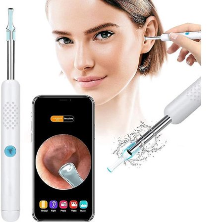 Otoskop, Öronotoskop, 1080p Öronkamera, Aibast Öronvaxborttagning, Öronendoskop, 6 LED-lampor, Lämplig för smartphones som A