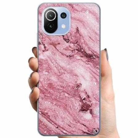Xiaomi 11 Lite 5g Ne Tpu Mobilskal Glitter Marble