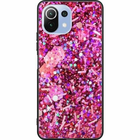 Xiaomi Mi 11 Lite Svart Skal Glitter