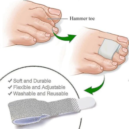 12-pack med hammartå-rätare för att räta ut hammartår