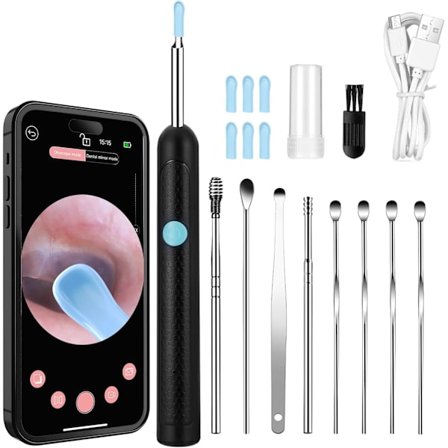 Öronotoskop, öronrengörare för vuxna med 3,5 mm lins och 6 lysdioder, 360° vidvinkelörspegel öronrengörare för iOS