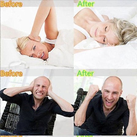 1-10X Tenner Tann Gnissing Sammenbiting Bruksisme Nattsøvn Beskyttelse Dental Munnskjerm